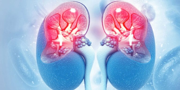 Legătura dintre hipertensiune și bolile renale